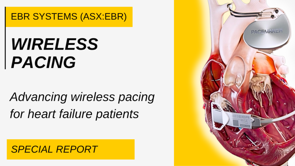 EBR Systema Wireless Pacing